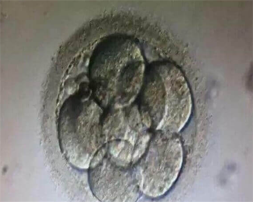 找浙江代生公司，浙江试管婴儿费用大约多少？在浙江做试管要花多少钱？