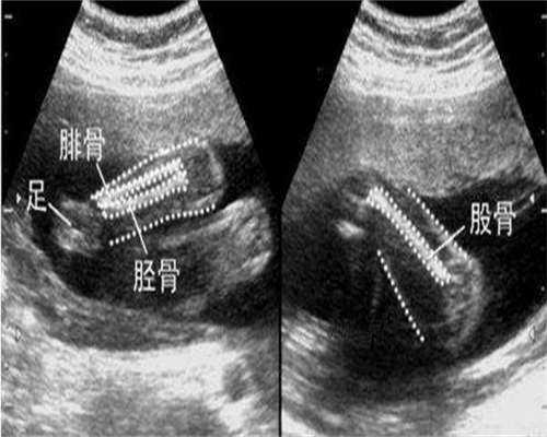 代妈浙江有找的吗，2026浙江产假最新规定？浙江产假是多少天？