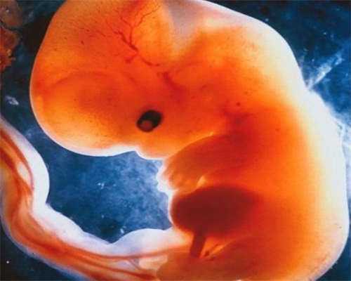 浙江艾滋病代生，2026年浙江产假多少天？2026浙江产假最新规定？