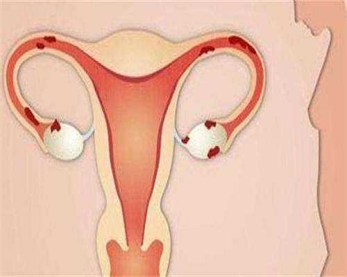 浙江供卵盲选，浙江湖州中备孕