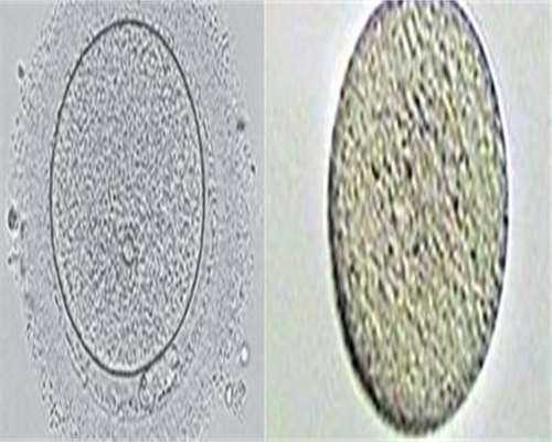 浙江捐卵妹怎么找，浙江产假多少天2026？2026浙江产假最新规定？