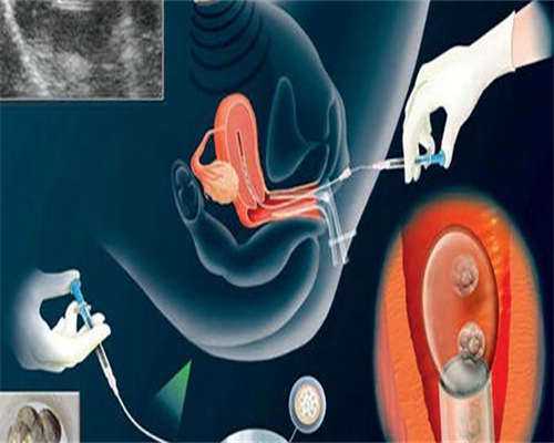 试管婴儿供卵代孕,试管婴儿移植双胞胎是真的吗？怎么才能得到双胞胎？