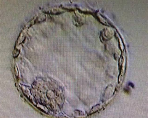 试管医院排名大全：温州试管婴儿医院哪家最好