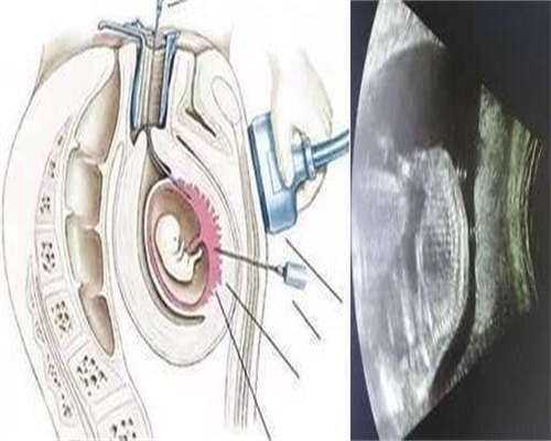 浙江代生机构公司,镇江试管婴儿公司中介机构选择有标准