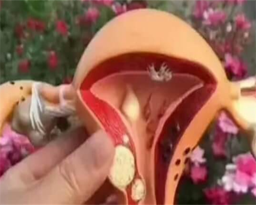 试管婴儿在排卵期取卵吗