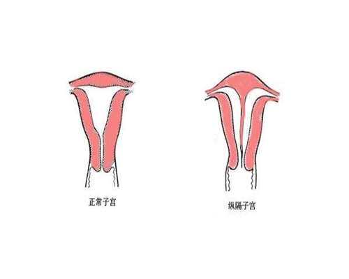 供卵增卵机构：试管婴儿可以筛查哪些疾病