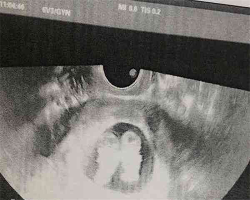 浙江能供卵吗，浙江产假多少天2026？2026浙江产假最新规定？