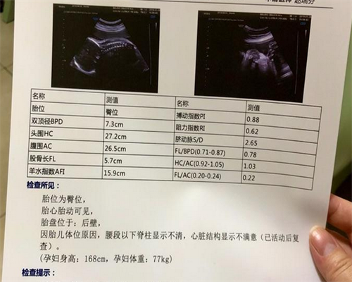 鲜胚移植第九天肚子刺痛